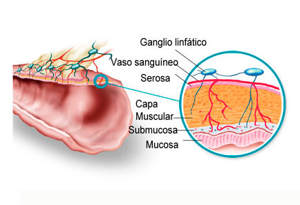 relación del colon y el sistema linfático
